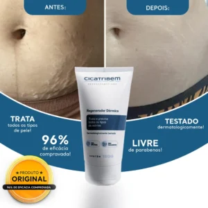 Cicatribem para estrias
